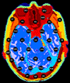 AnalogBrain