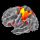 neurorecovery