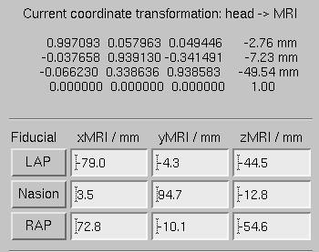 Example of an initial coordinate alignment