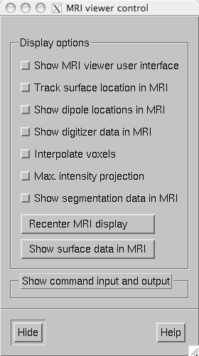 MRI viewer window