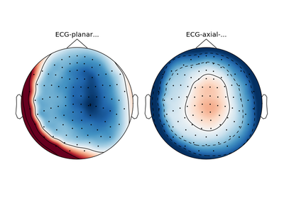 ../_images/sphx_glr_plot_artifacts_correction_ssp_thumb.png