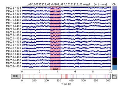 ../_images/sphx_glr_plot_brainstorm_auditory_thumb.png