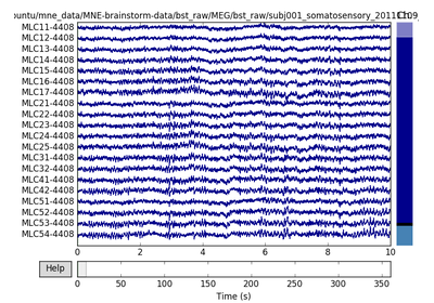 ../_images/sphx_glr_plot_brainstorm_data_thumb.png