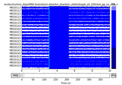 ../_images/sphx_glr_plot_brainstorm_phantom_elekta_thumb.png