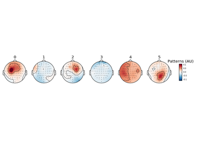 ../_images/sphx_glr_plot_decoding_csp_eeg_thumb.png