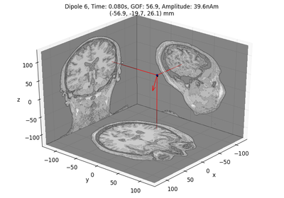 ../_images/sphx_glr_plot_dipole_fit_thumb.png