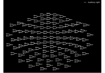 ../_images/sphx_glr_plot_elekta_epochs_thumb.png