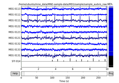 ../_images/sphx_glr_plot_epoching_and_averaging_thumb.png