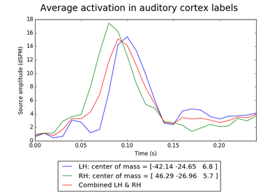 ../_images/sphx_glr_plot_label_activation_from_stc_thumb.png