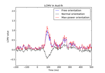 ../_images/sphx_glr_plot_lcmv_beamformer_thumb.png