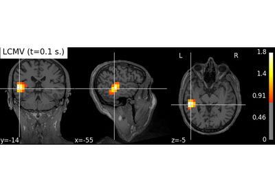 ../_images/sphx_glr_plot_lcmv_beamformer_volume_thumb.png