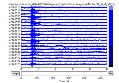 ../_images/sphx_glr_plot_megsim_data_thumb.png