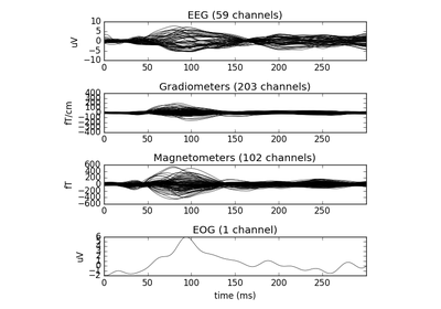 ../_images/sphx_glr_plot_mixed_norm_inverse_thumb.png