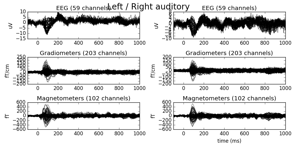 ../_images/sphx_glr_plot_object_epochs_002.png