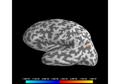 ../_images/sphx_glr_plot_point_spread_thumb.png