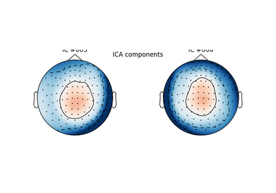 ../_images/sphx_glr_plot_run_ica_thumb.png