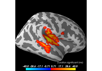 ../_images/sphx_glr_plot_stats_cluster_spatio_temporal_2samp_thumb.png