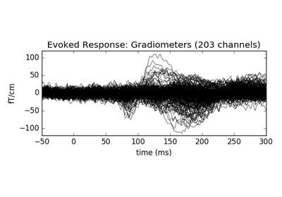 ../_images/sphx_glr_plot_time_frequency_mixed_norm_inverse_thumb.png