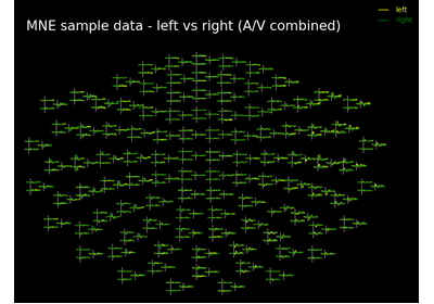 ../_images/sphx_glr_plot_topo_compare_conditions_thumb.png