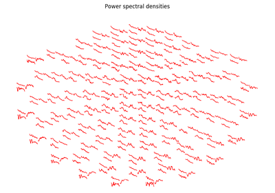 ../_images/sphx_glr_plot_topo_customized_thumb.png