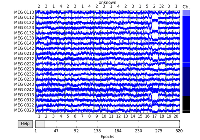 ../_images/sphx_glr_plot_visualize_epochs_thumb.png